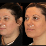 Sculptra Fillers and Self-Care: Best Doctors in Dubai Share Their Favorite Rituals