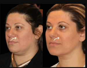 Sculptra Fillers and Self-Care: Best Doctors in Dubai Share Their Favorite Rituals