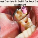 Best Dentists in Delhi for Root Canal Treatment