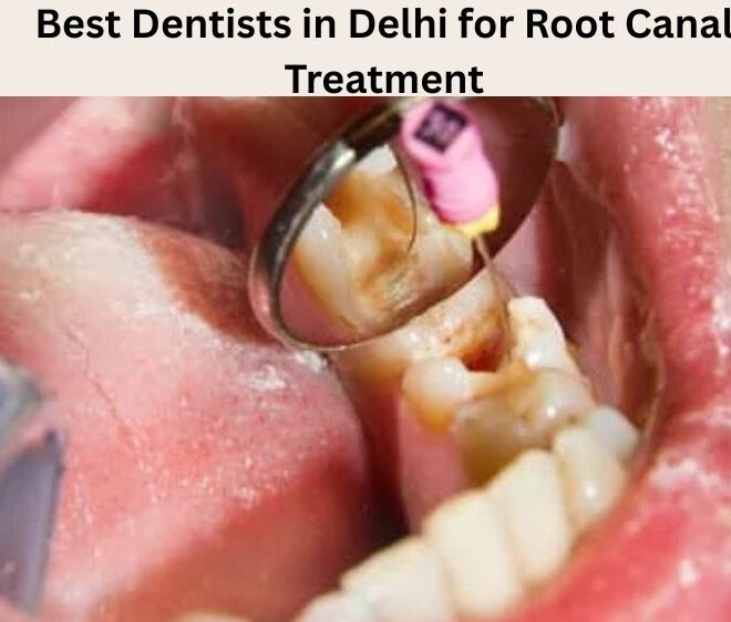 Best Dentists in Delhi for Root Canal Treatment