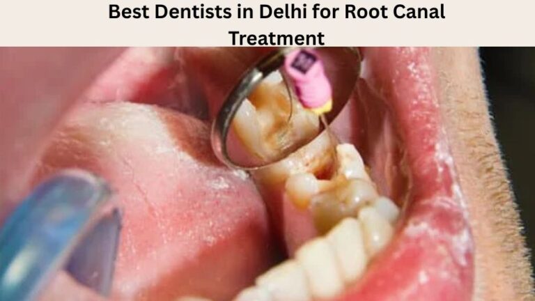 Best Dentists in Delhi for Root Canal Treatment