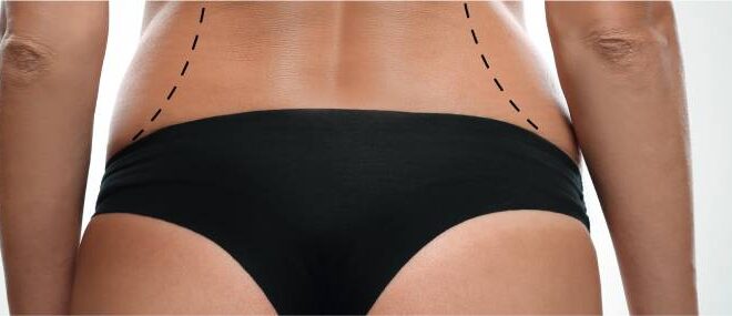 Body Contouring in Dubai: Achieve Your Ideal Shape with Customized Solutions
