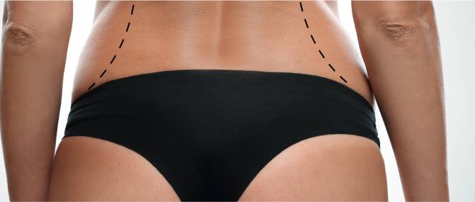 Body Contouring in Dubai: Achieve Your Ideal Shape with Customized Solutions
