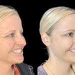 Experience Smooth Results at the Best Aesthetic Clinics in Dubai for Botox