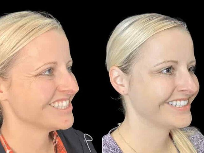 Experience Smooth Results at the Best Aesthetic Clinics in Dubai for Botox