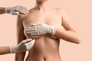 How the Best Breast Augmentation Surgeons in Dubai Customize Results for Every Patient