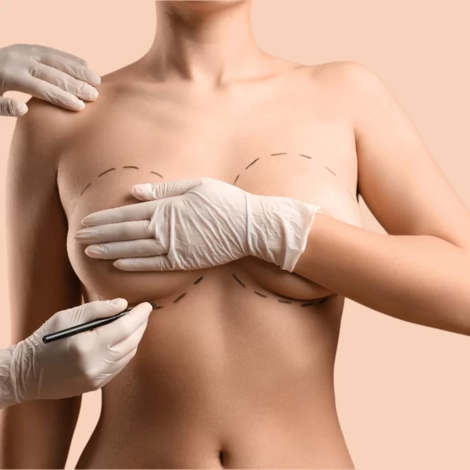How the Best Breast Augmentation Surgeons in Dubai Customize Results for Every Patient
