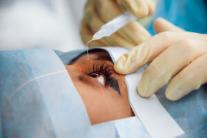 Understanding the Benefits of Refractive Cataract Surgery in Dubai