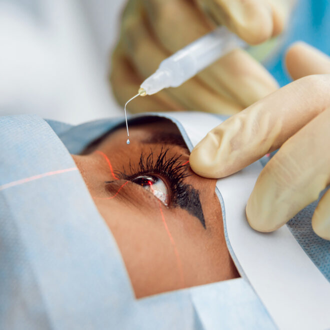 Understanding the Benefits of Refractive Cataract Surgery in Dubai