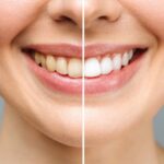 Find the Best Dental Clinic in Lucknow Near Me – Quick & Easy
