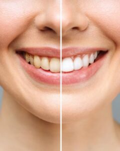 Find the Best Dental Clinic in Lucknow Near Me – Quick & Easy
