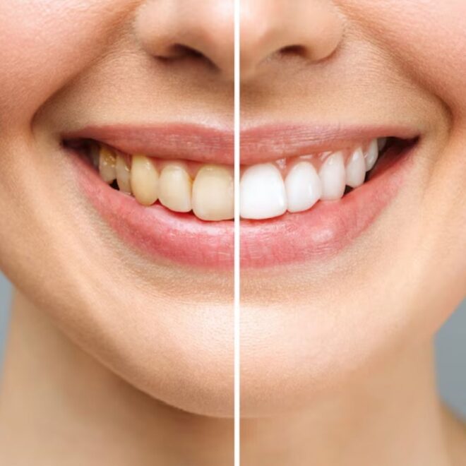 Find the Best Dental Clinic in Lucknow Near Me – Quick & Easy