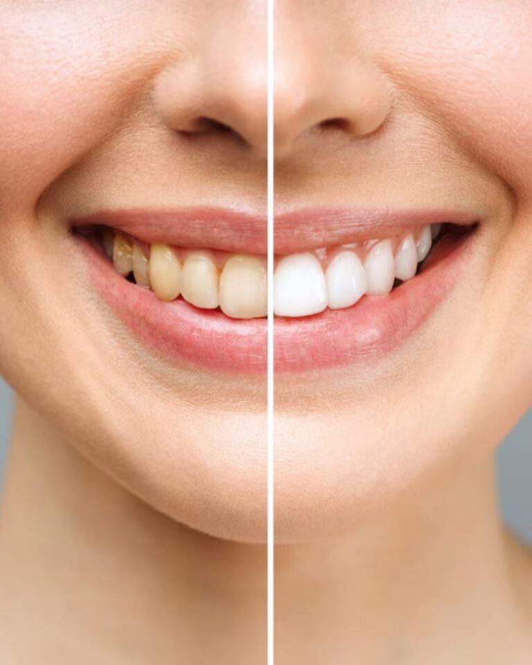 Find the Best Dental Clinic in Lucknow Near Me – Quick & Easy