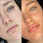 Dubai’s Best Plastic Surgeons for Natural-Looking Enhancements