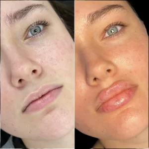Dubai’s Best Plastic Surgeons for Natural-Looking Enhancements