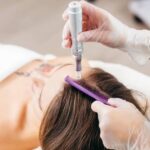 PRP for Hair: A Industry That Keeps Growing