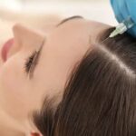 What to Know Before You Try Hair PRP: Real Results & Side Effects