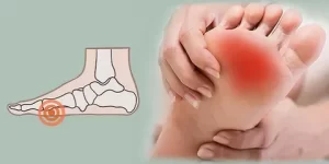 Relieve Metatarsalgia Pain with Footcare Experts in Edinburgh