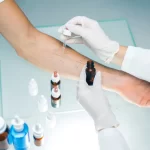 Allergy Testing: Types, Benefits, and What to Expect