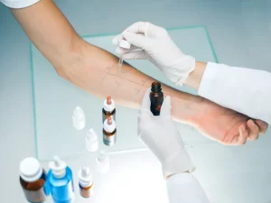 Allergy Testing: Types, Benefits, and What to Expect