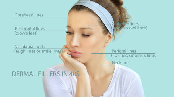 Top 5 Mistakes to Avoid When Getting Botox or Fillers