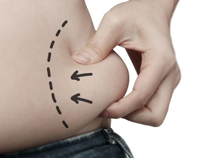 Model Measurements, Medical Means: How Liposuction Fits Fashion’s Frame