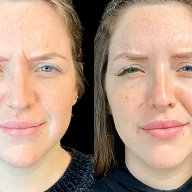 Best Plastic Surgeons in dubai Explain How Botox Can Boost Your Confidence