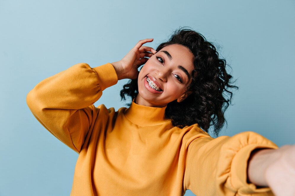 Invisalign aligners