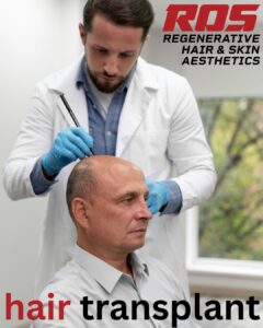 Effective and Budget-Friendly Hair Restoration Treatments in Hyderabad