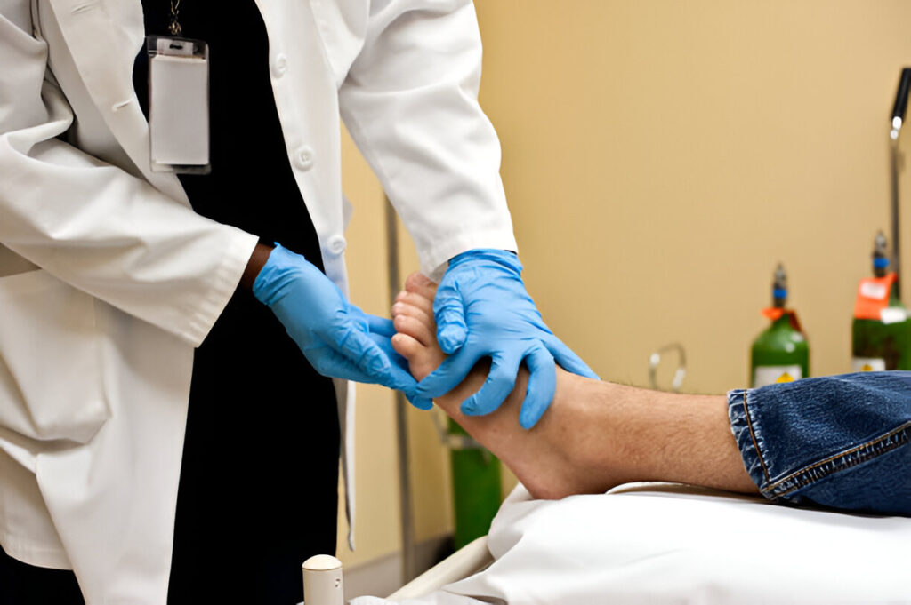 Charcot Foot