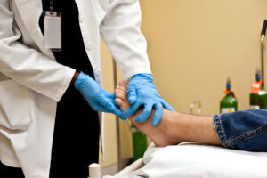 How to Manage and Treat Charcot Foot: A Complete Guide for Diabetic Patients