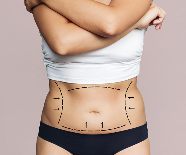 Tummy Tuck Dubai: How to Choose the Right Surgeon for Your Tummy Tuck Surgery
