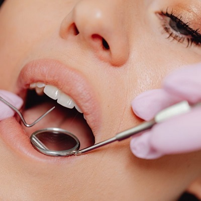 5 Common Myths About Dental Implants—Debunked