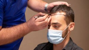 Robotic Hair Transplant: Is It Available in Islamabad?