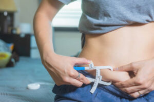 Riyadh’s Liposuction Success Stories
