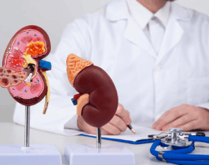 How to Choose the Best Kidney Transplant Surgeon in Jaipur: A Complete Guide