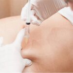 Slim Down Fast with Non-Surgical Weight Loss Injections