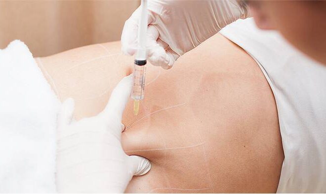 Slim Down Fast with Non-Surgical Weight Loss Injections