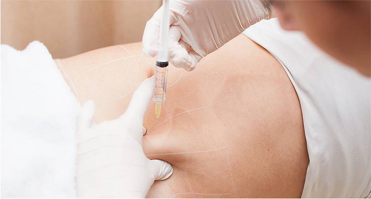 weight loss injections