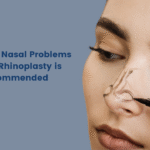 Common Nasal Problems Where Rhinoplasty is Recommended Common Nasal Problems
