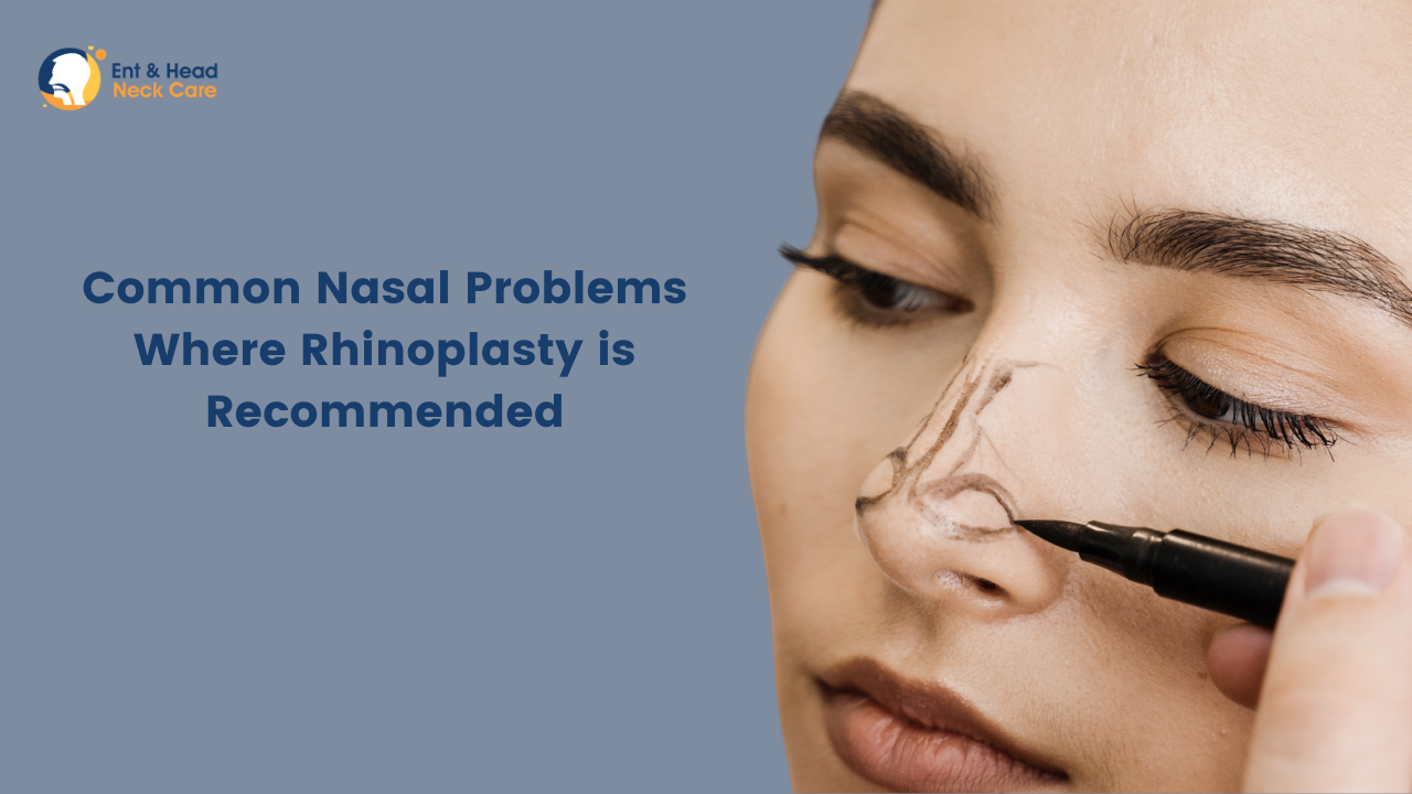 Common Nasal Problems