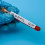 Pure Maheshwari Silk Sarees: Where Tradition Meets Timeless Style Hepatitis B Test in Dubai