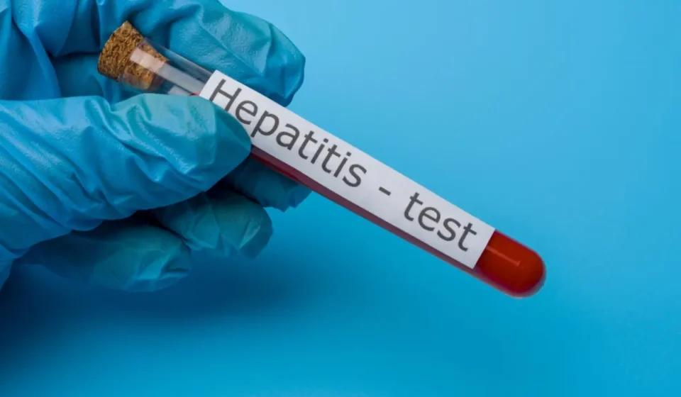 Hepatitis B Test in Dubai