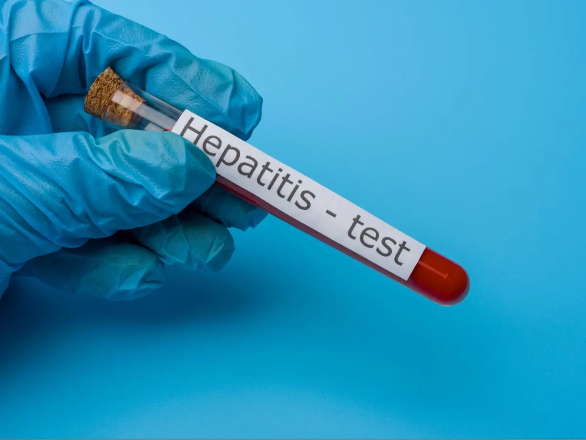 Hepatitis B Test in Dubai
