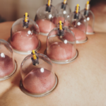 Not All Pizzas Are Spicy… Until You Try Peri Peri Pizza cupping treatment