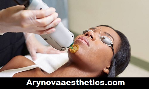 Best Laser Hair Removal in Chicago Professional Permanent Solutions