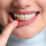 Why Advanced Cleaning Methods Are Essential for NYC Offices Gum Swelling 2 Weeks After Tooth Extraction